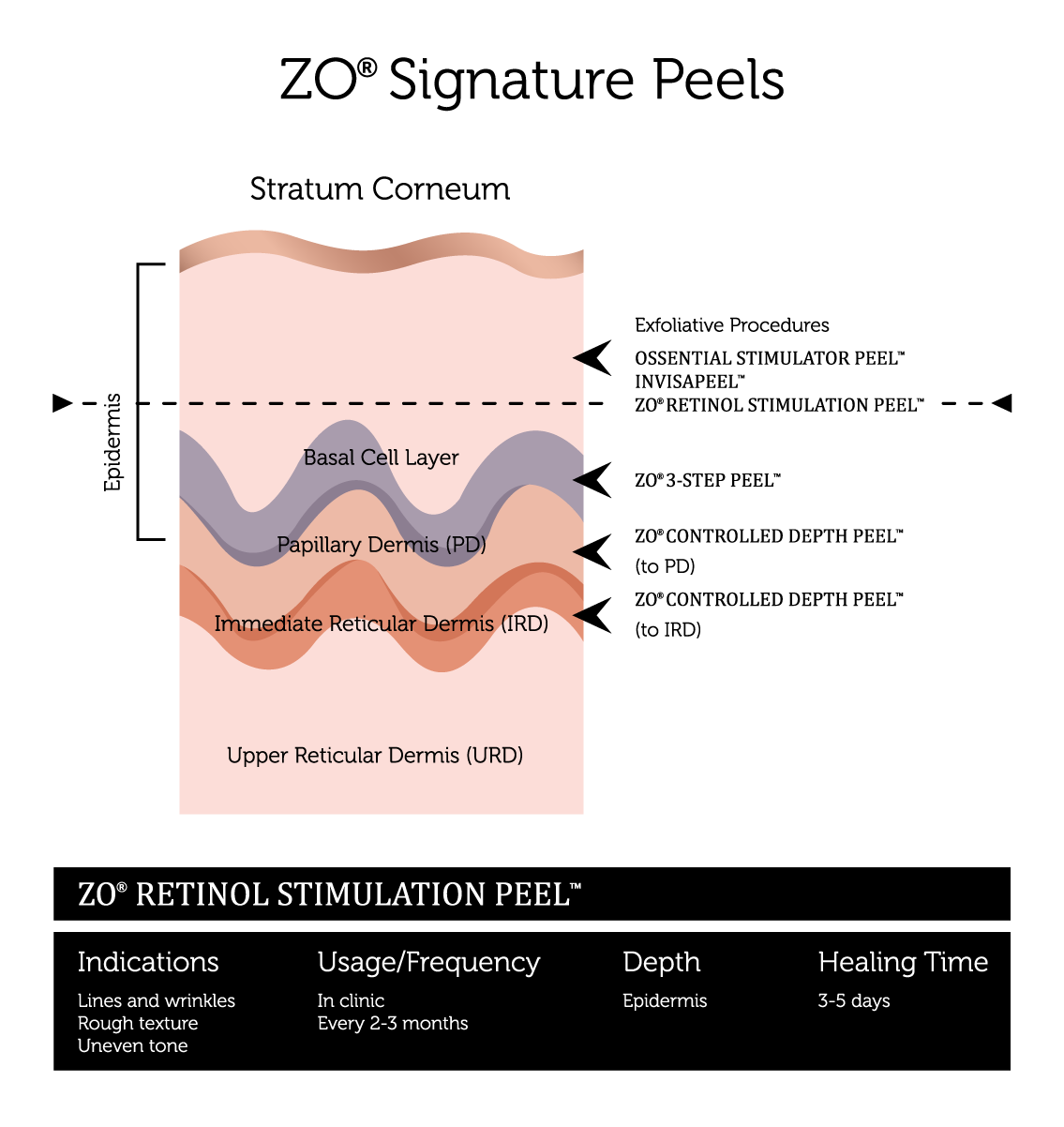 Chemical-Peels-(3)