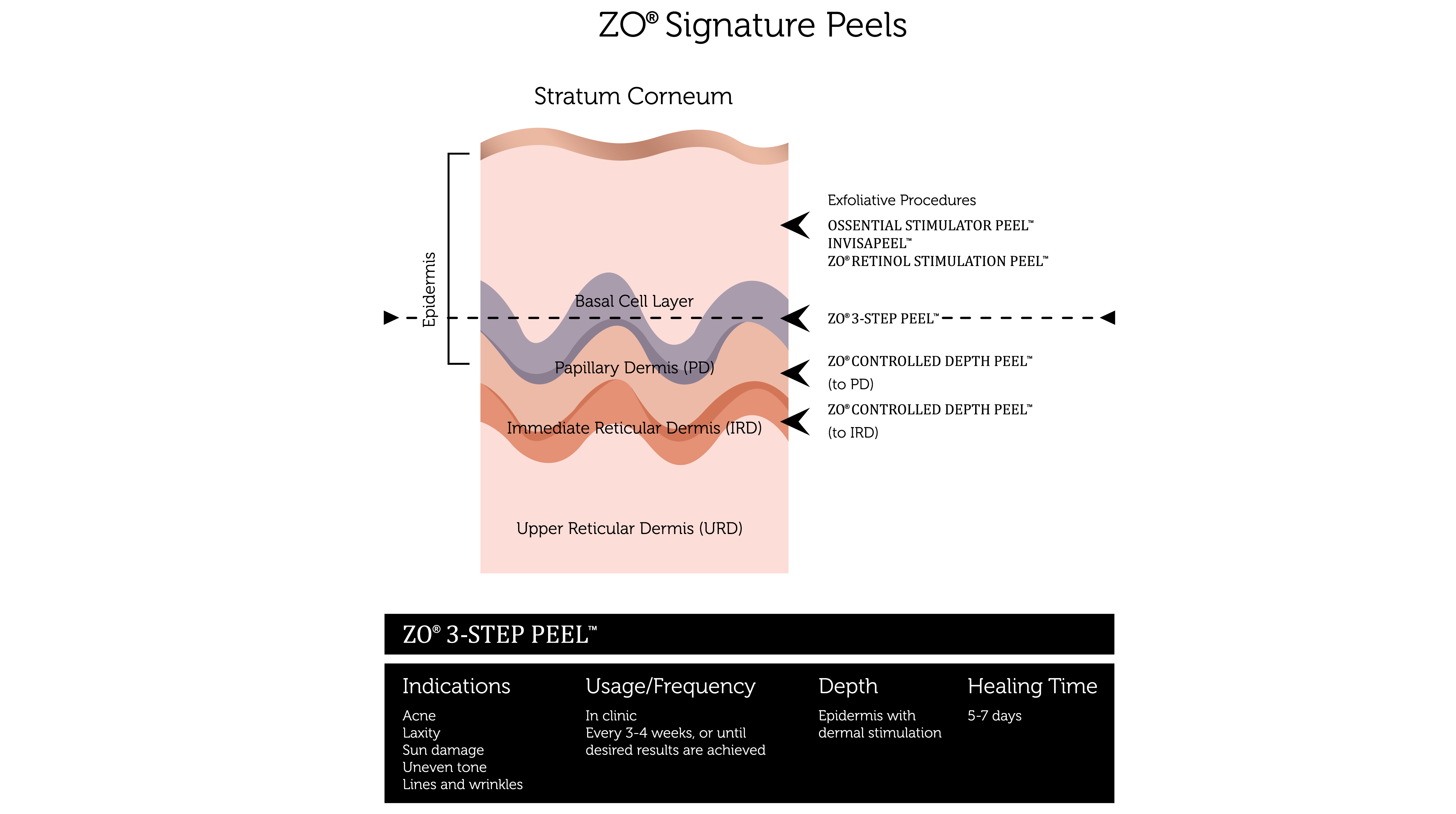 Chemical Peels (4)-01