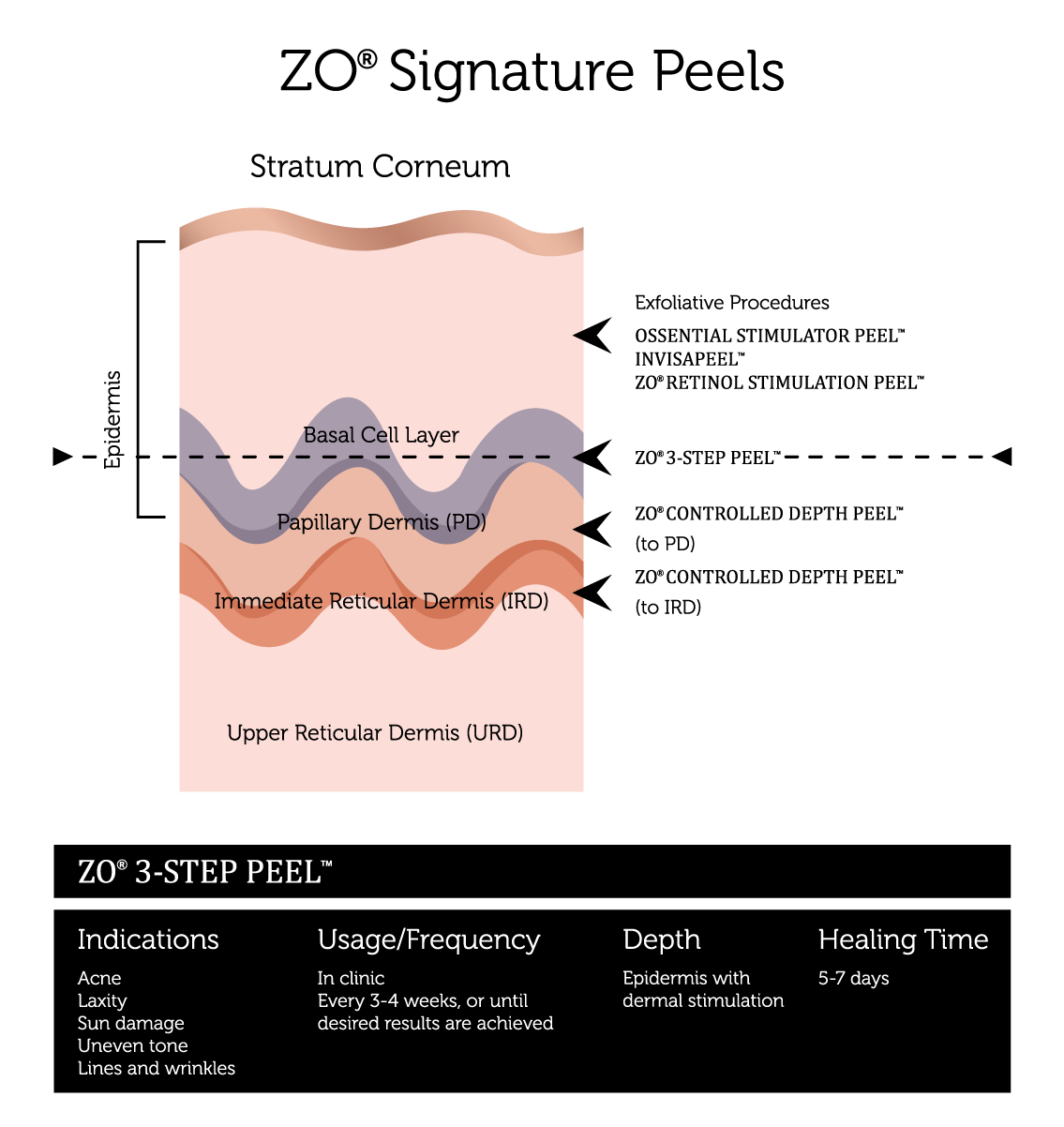 Chemical-Peels-(4)