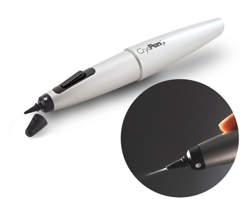 Can cryotherapy cause permanent hypopigmentation? 2 Cryopen 01