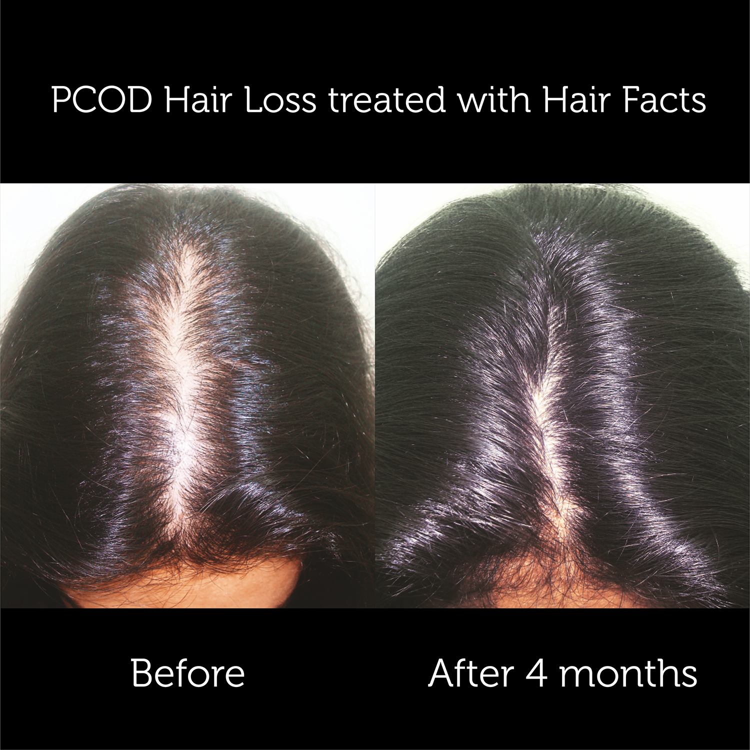 Hair Facts Supplements 1