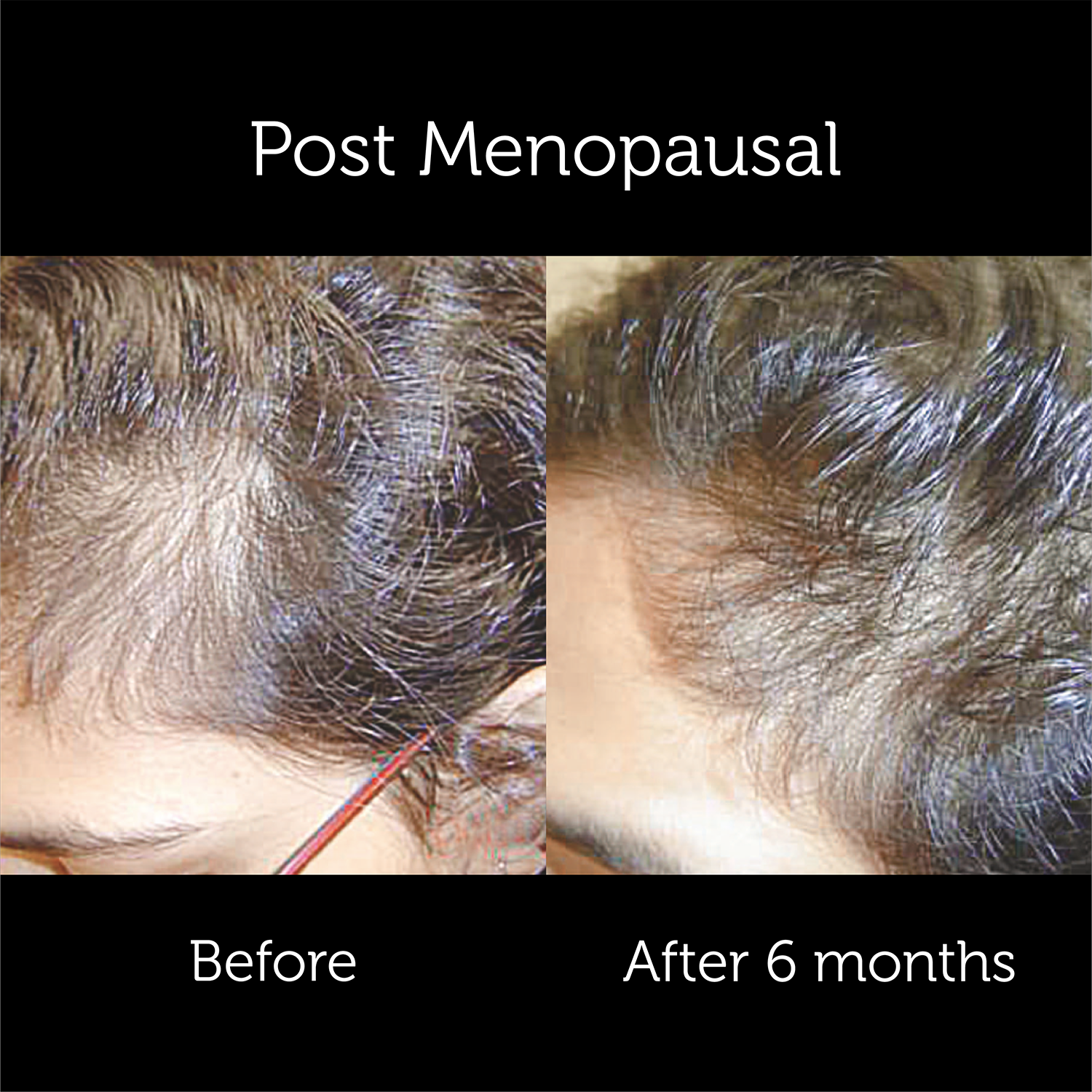 Hair Facts Supplements 2