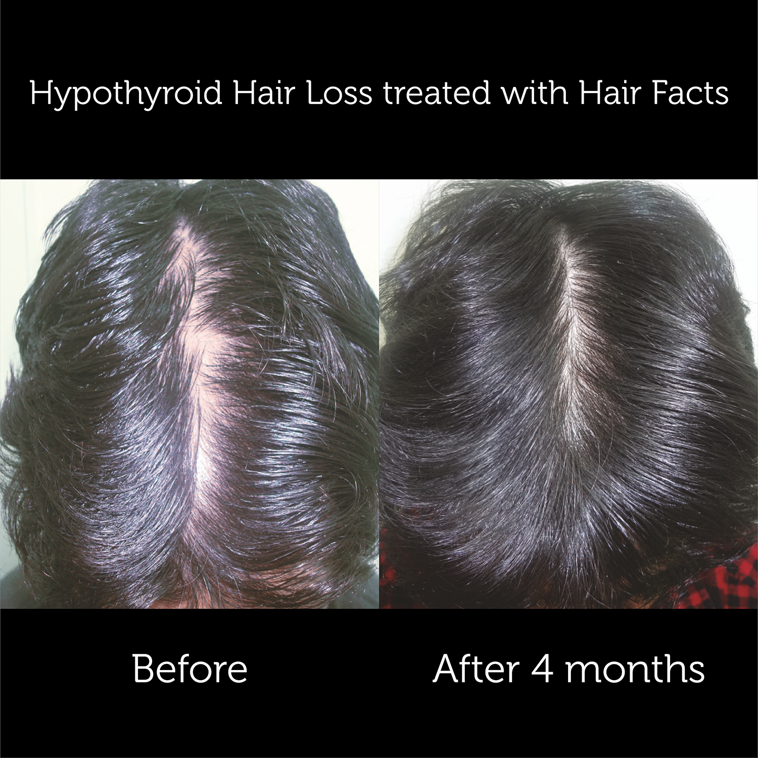 Hair Facts Supplements 3
