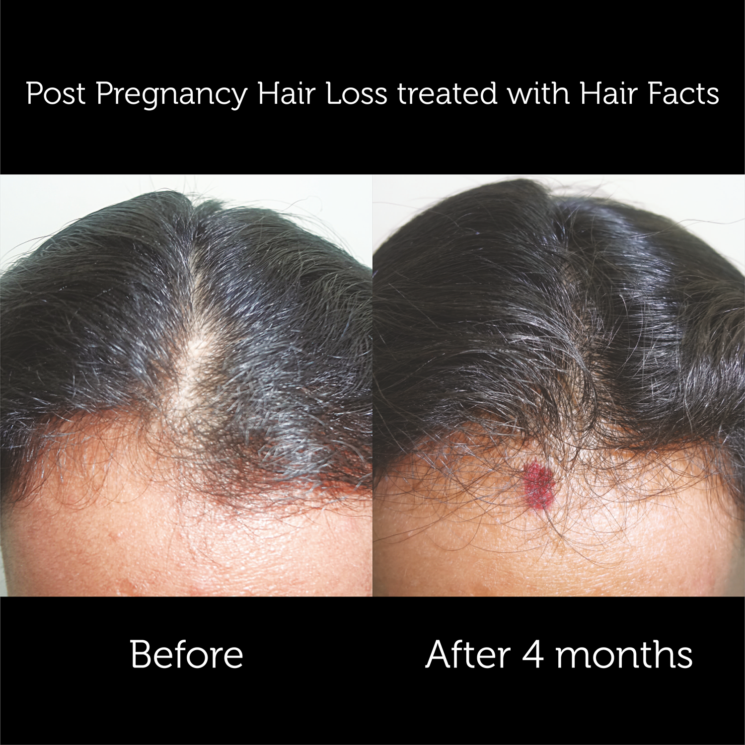 Hair Facts Supplements 4
