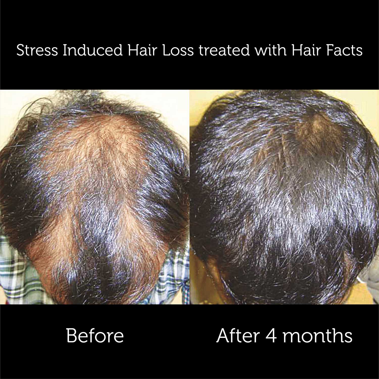 Hair Facts Supplements 5