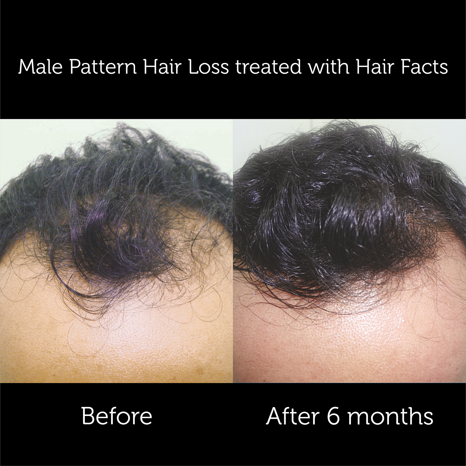 Hair Facts Supplements 6