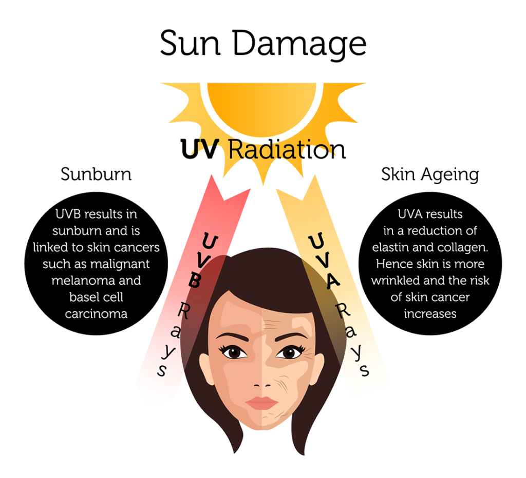Sun Damage & Photoaging Treatment in London Rejuvence Clinic