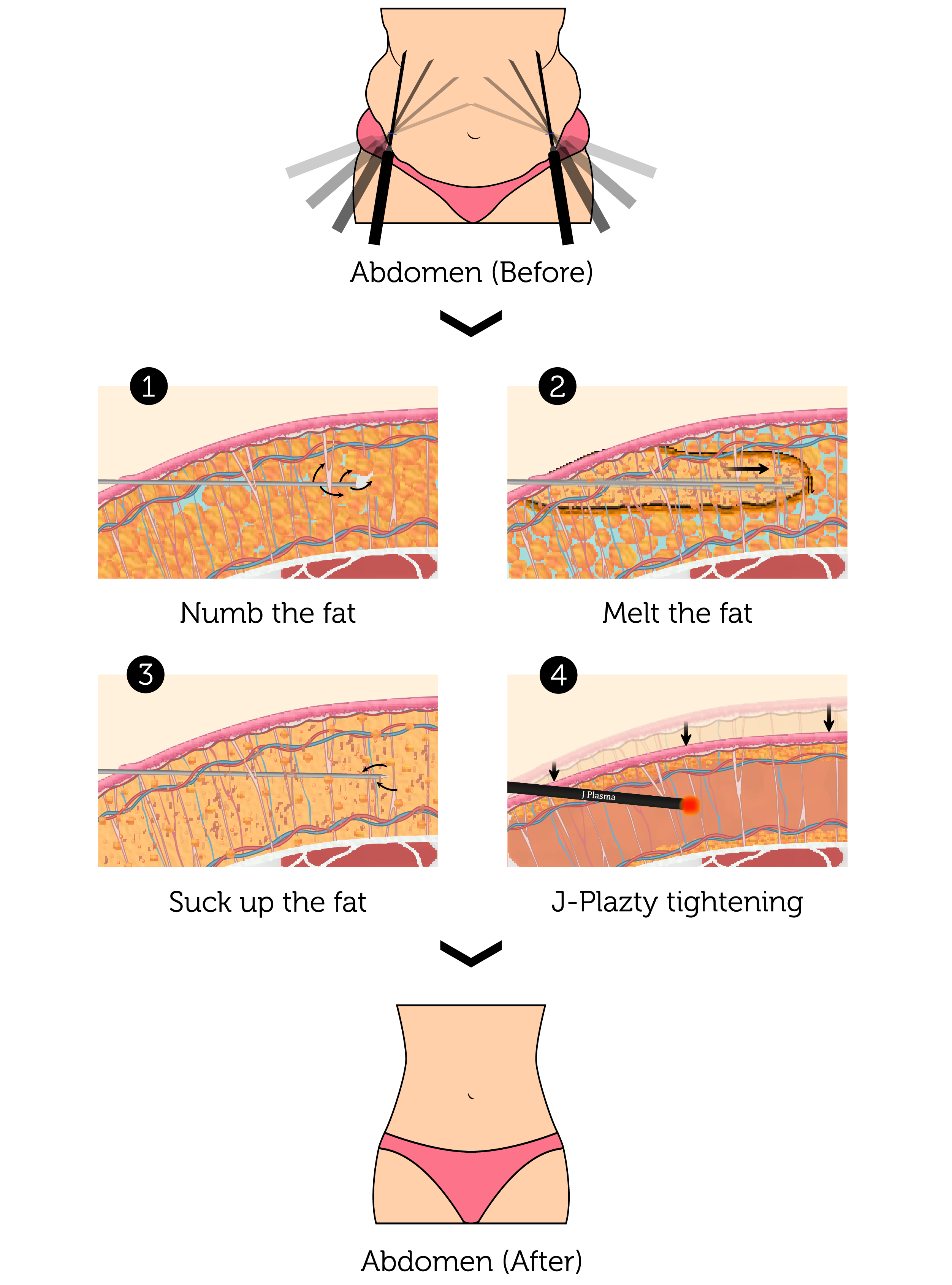 J-Plazty Abs (Female)-01