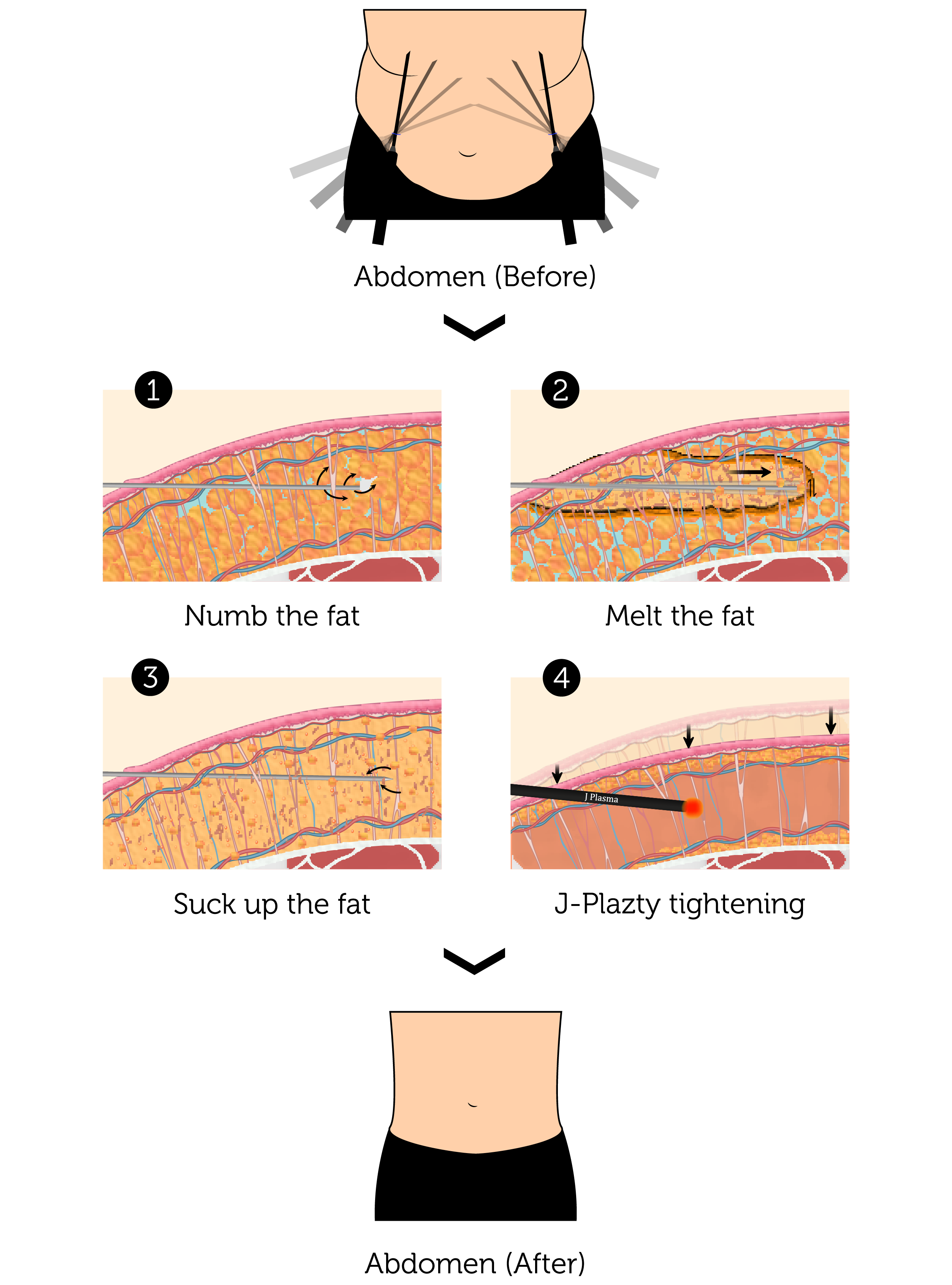 J-Plazty Abs (Male)-01