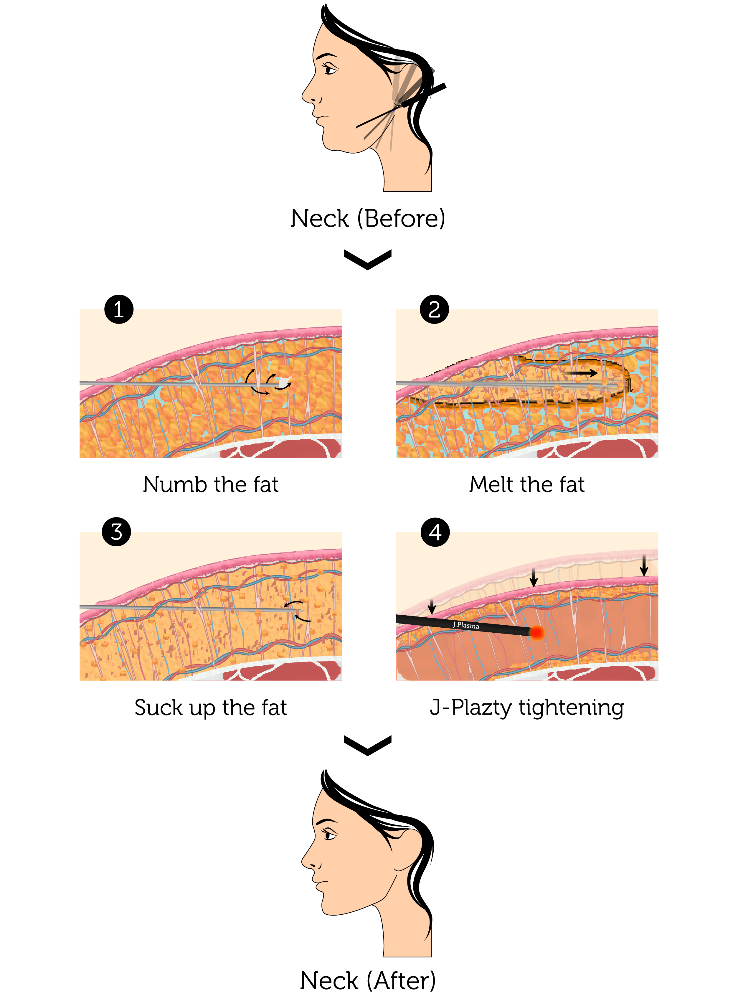 J-Plazty Neck (Female)-01