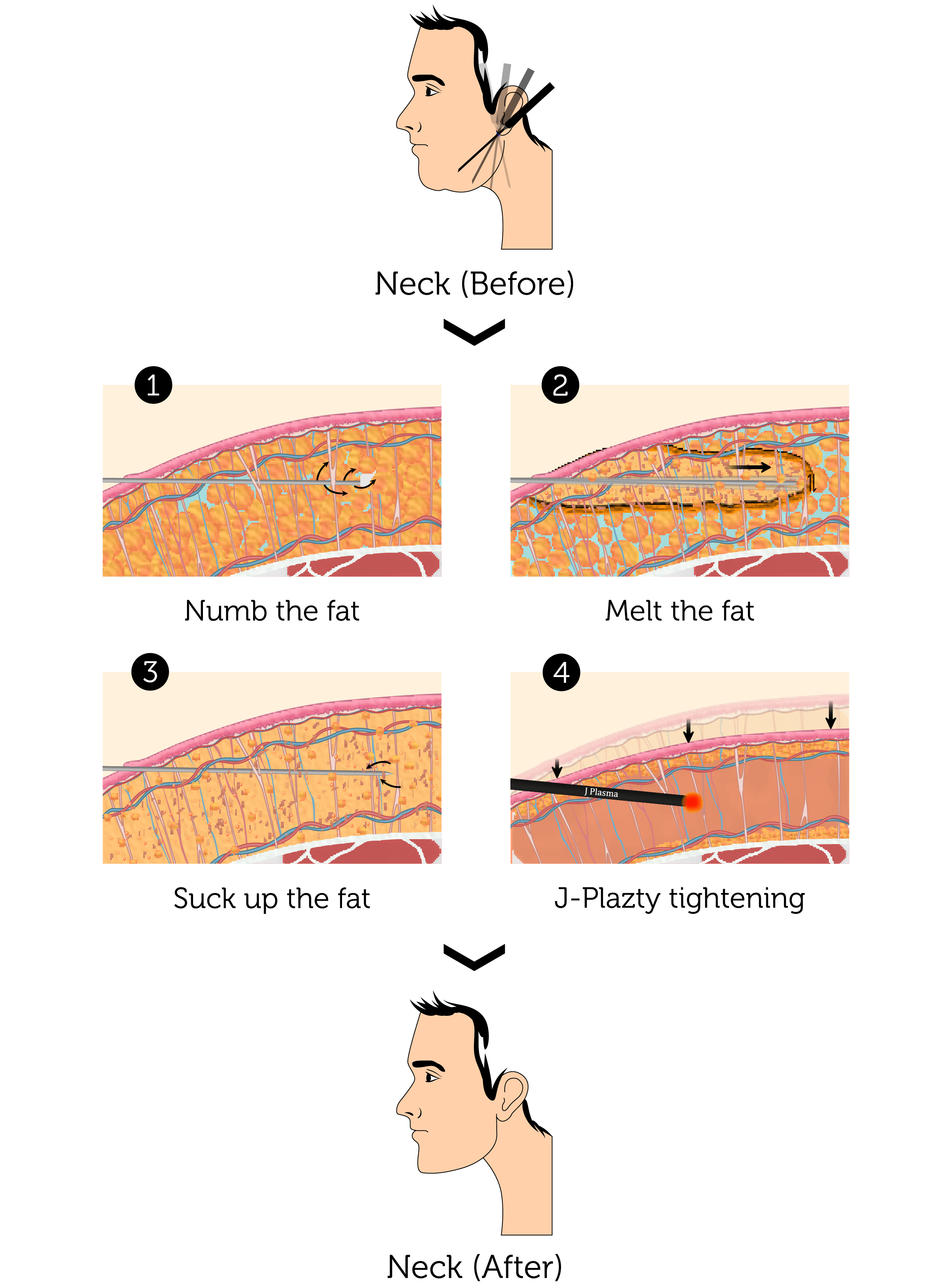 J-Plazty Neck (Male)-01