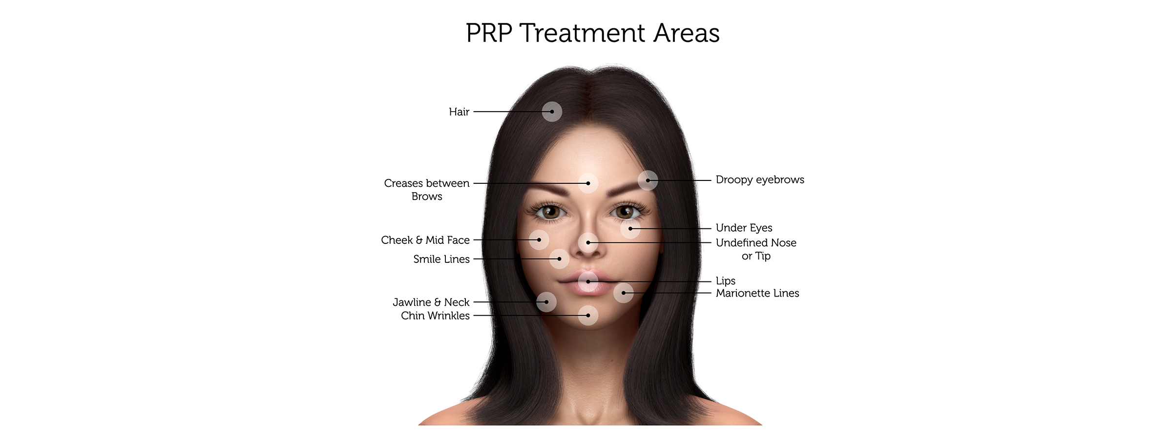 PRP-Treatment-Areas-(Female)