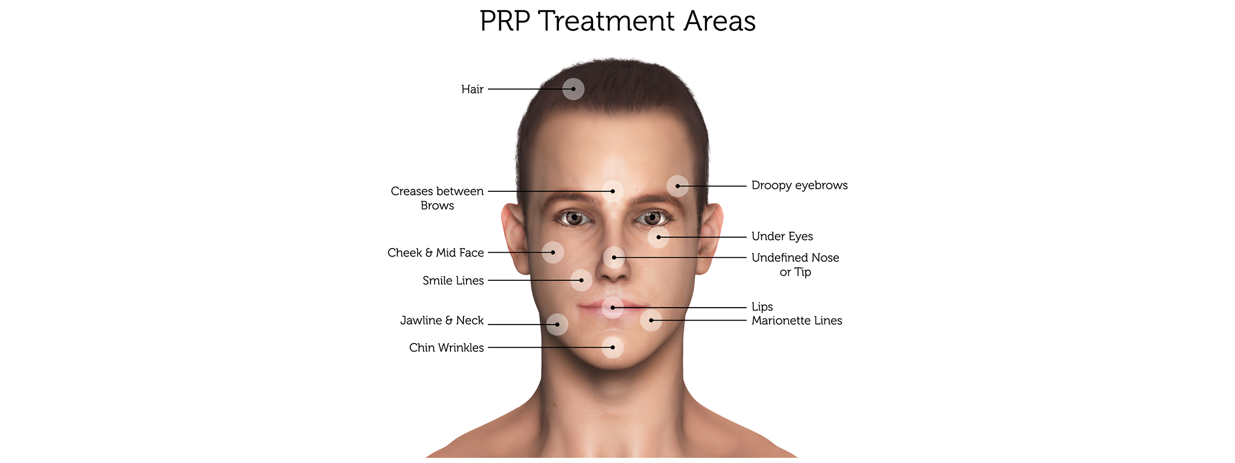 PRP-Treatment-Areas-(Male)