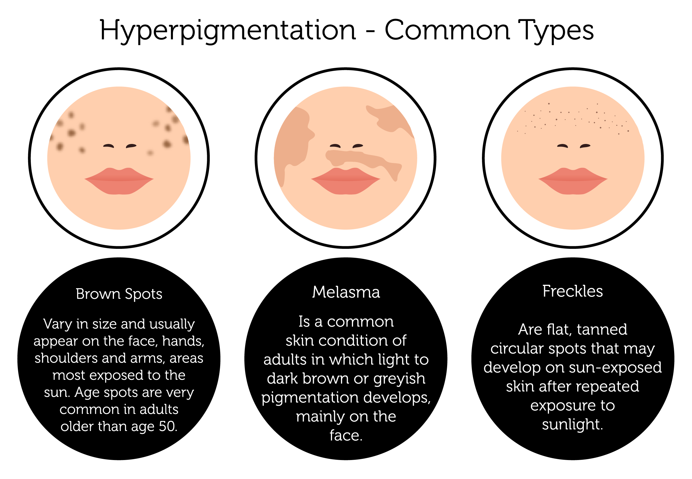 skin pigmentation brown patches