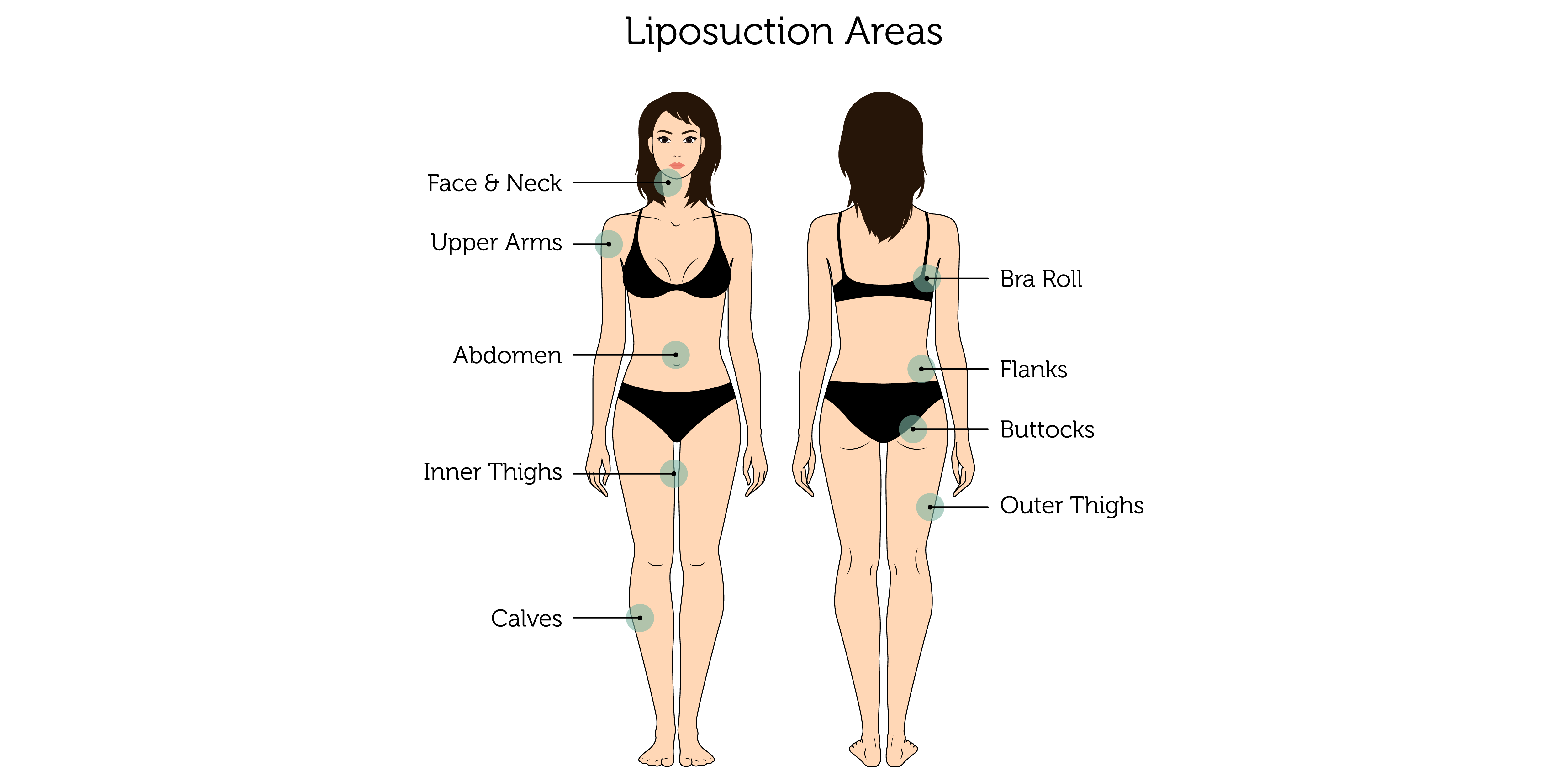 Liposuction Areas (Female)-01