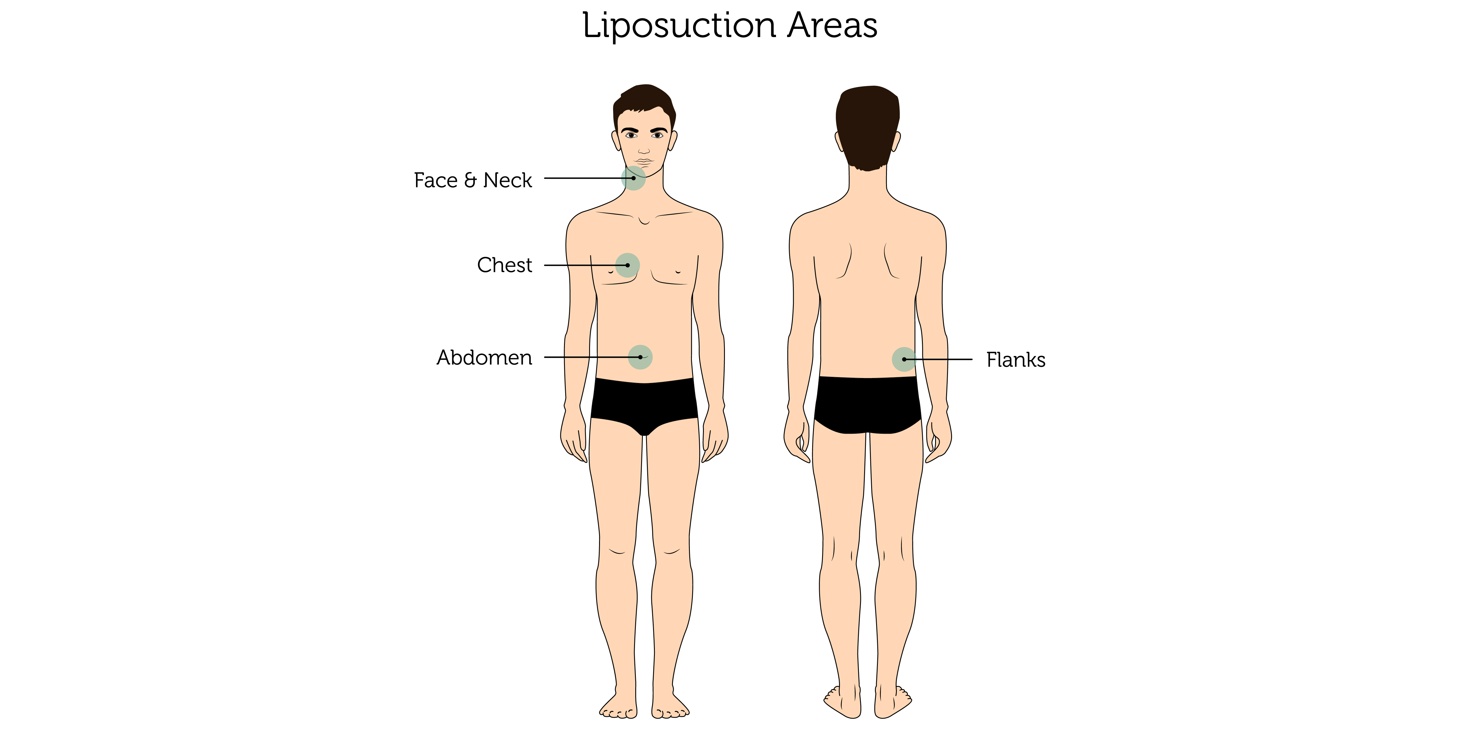 Liposuction Areas (Male)-01 (2)