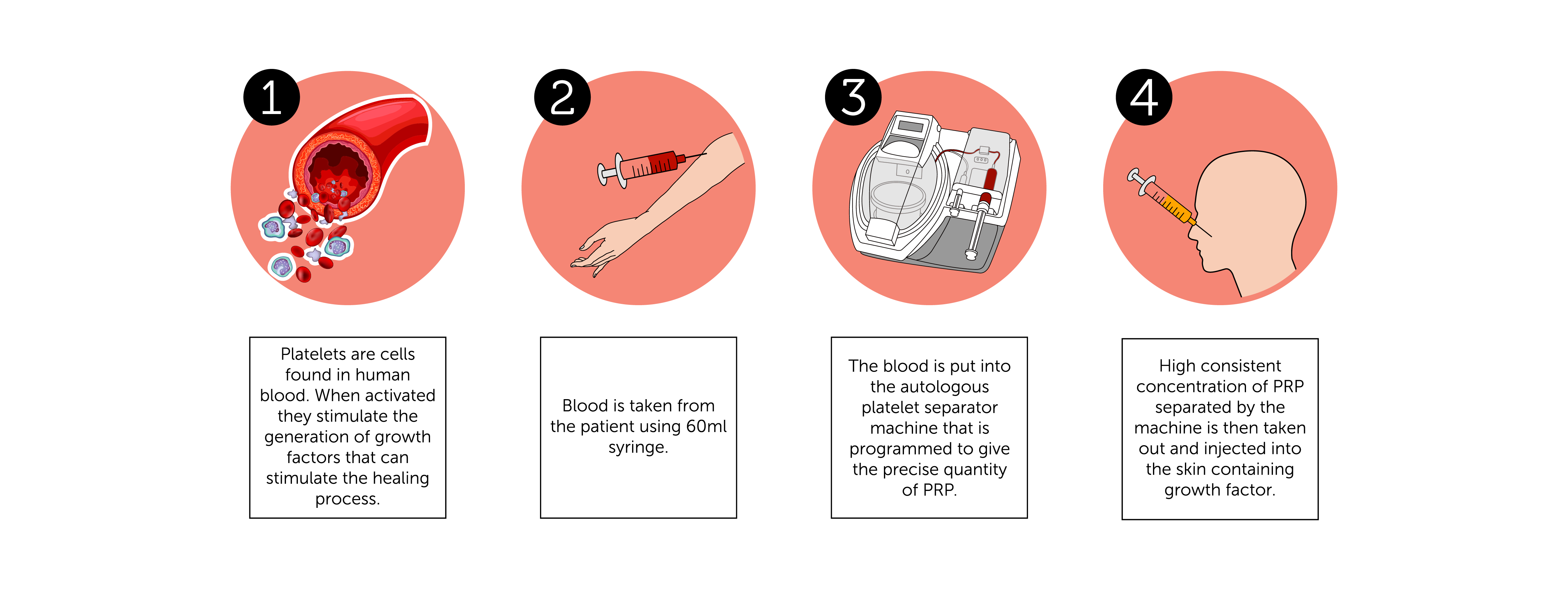 PRP Procedure for Face 1-01