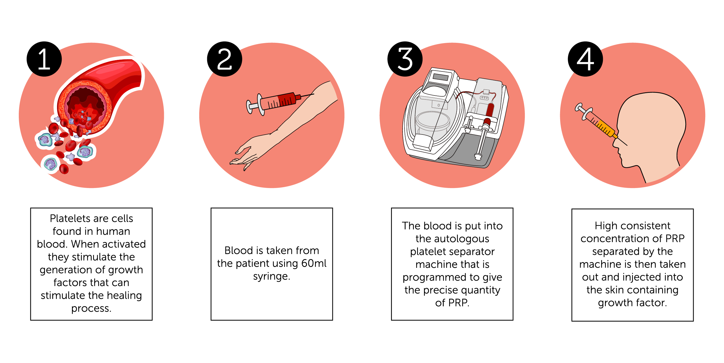 PRP Procedure for Face 2-01