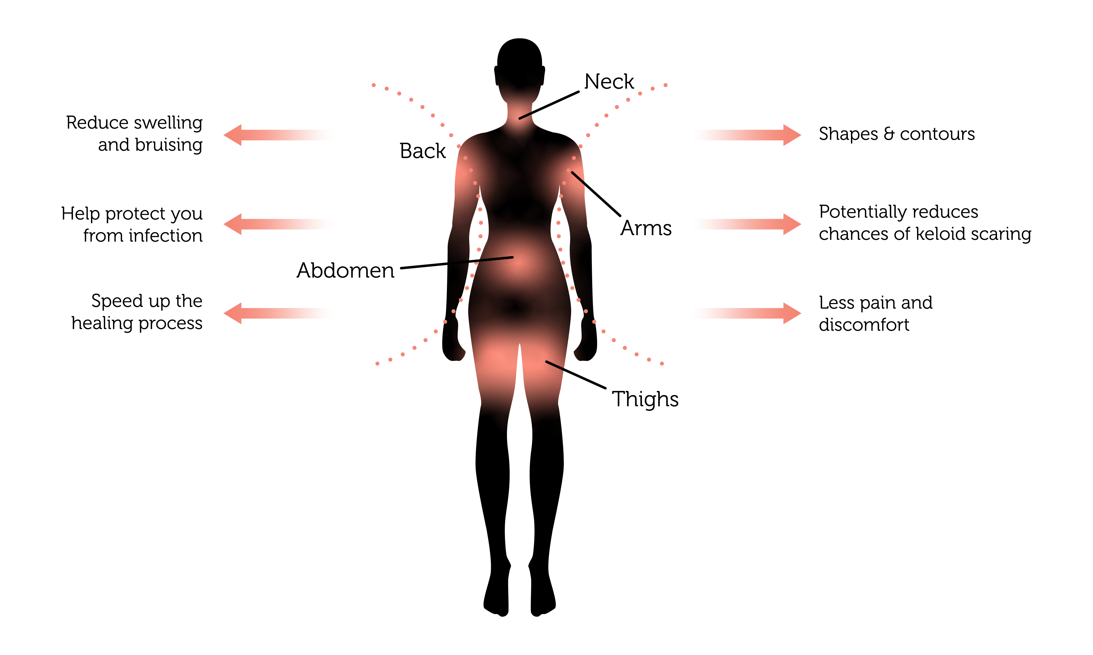 Why Are Compression Garments Essential for Healing?