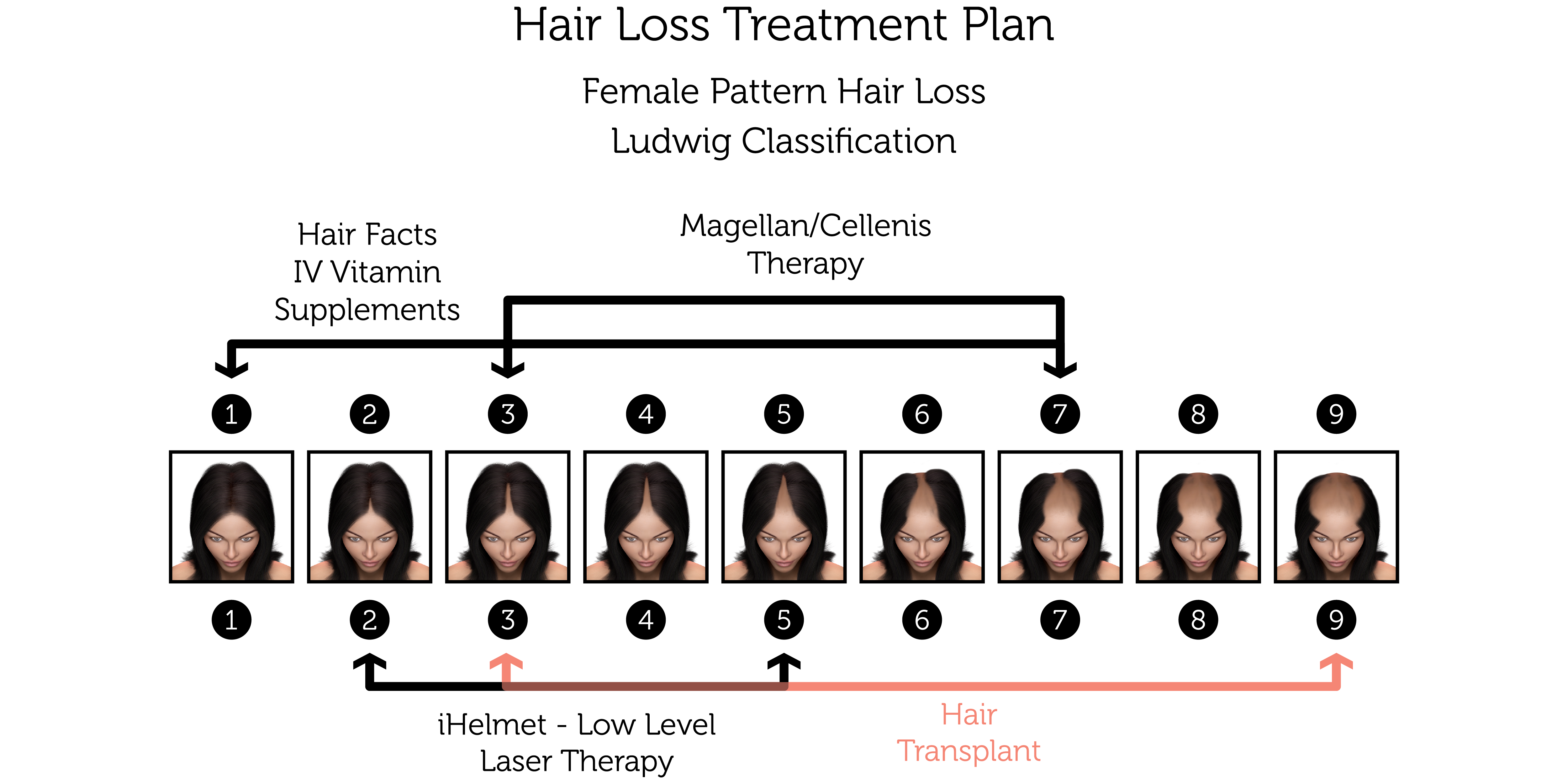 Hair Loss Treatment Plan (Female)-01