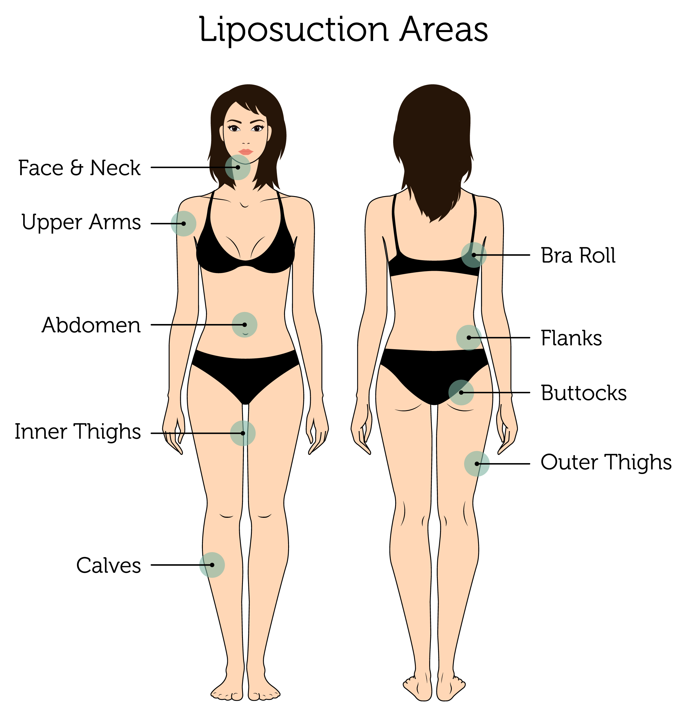 Liposuction Areas (Female)-01