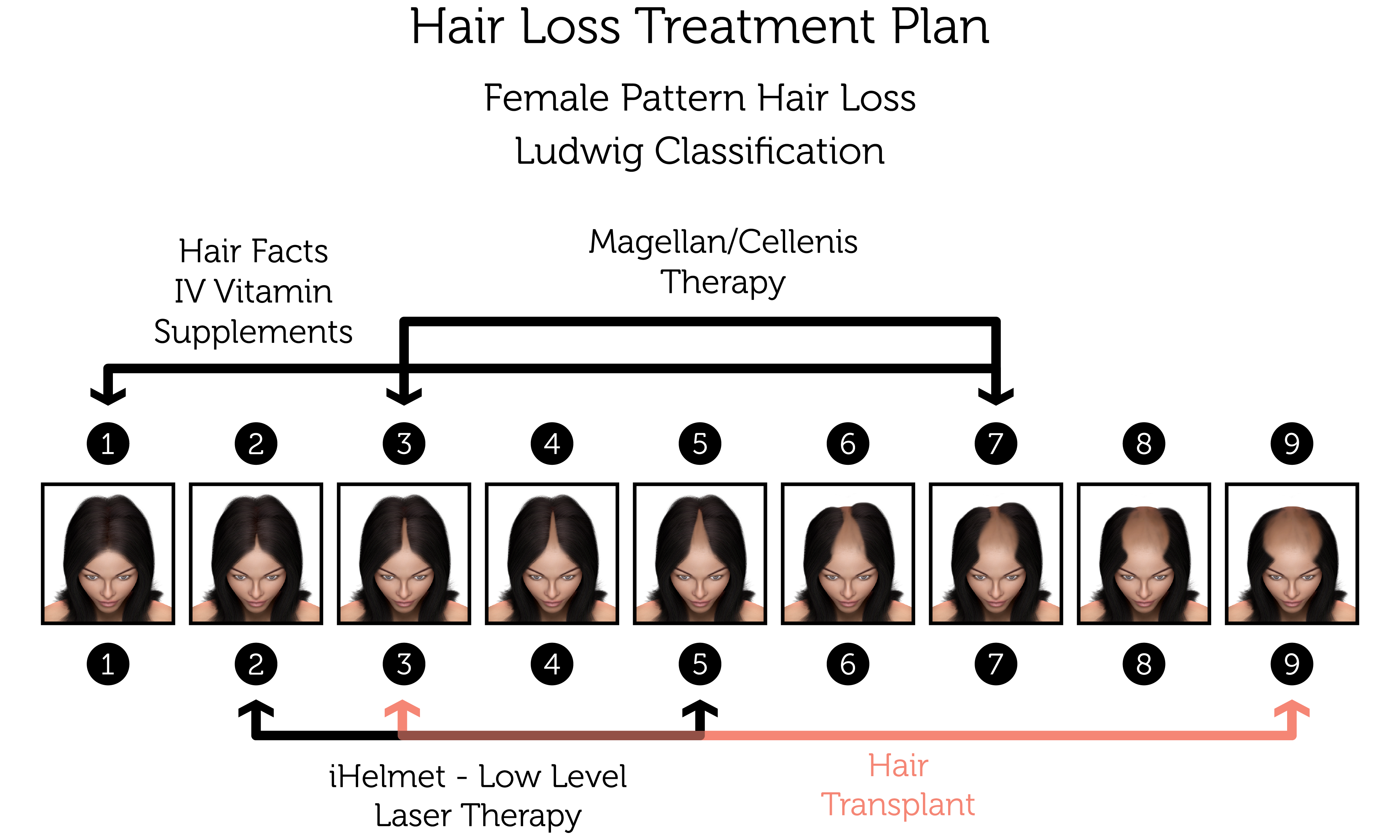 Female Pattern Hair Loss Treatment | Rejuvence Clinic