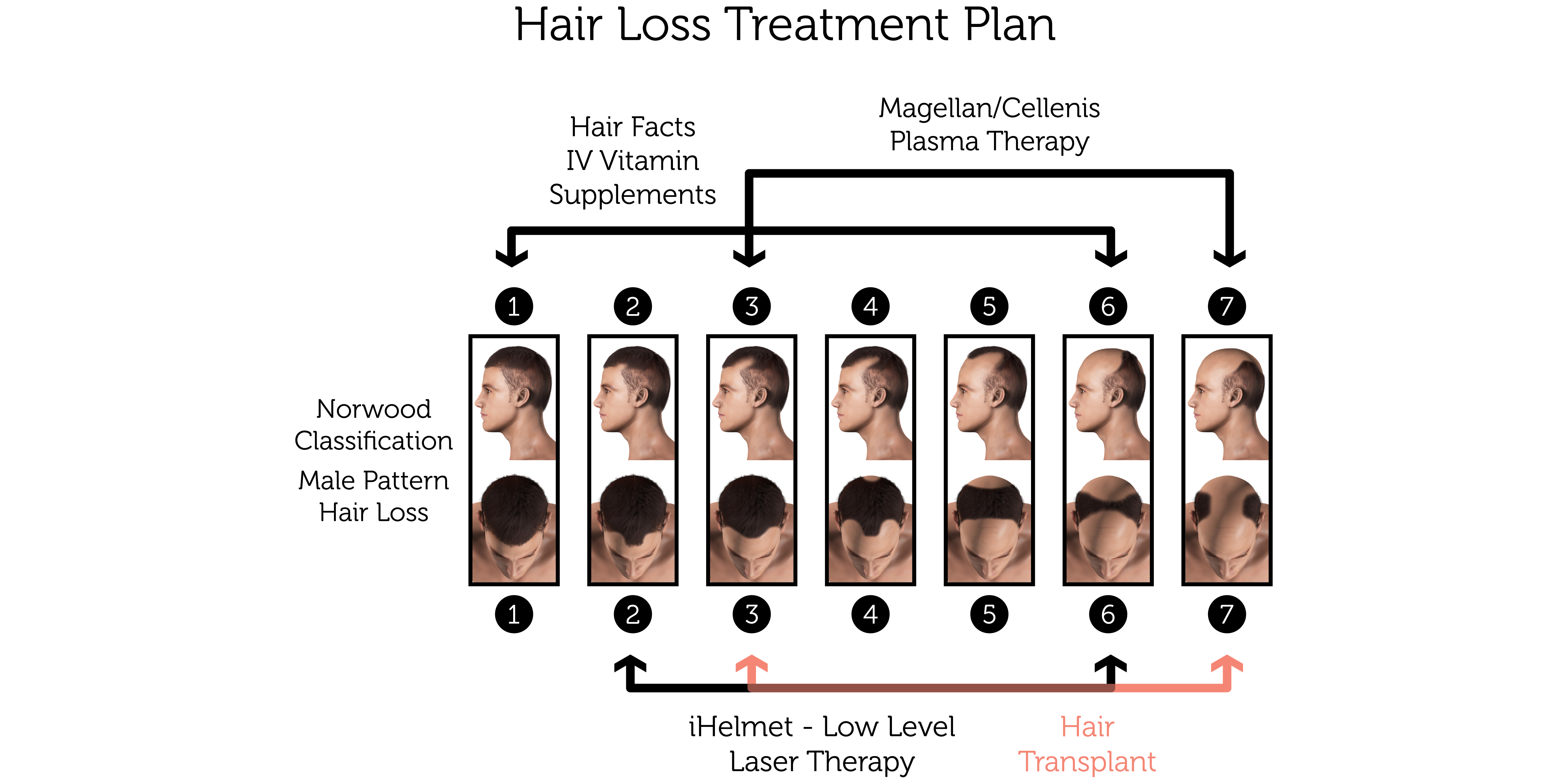 Hair Loss Treatment Plan (Male)-01