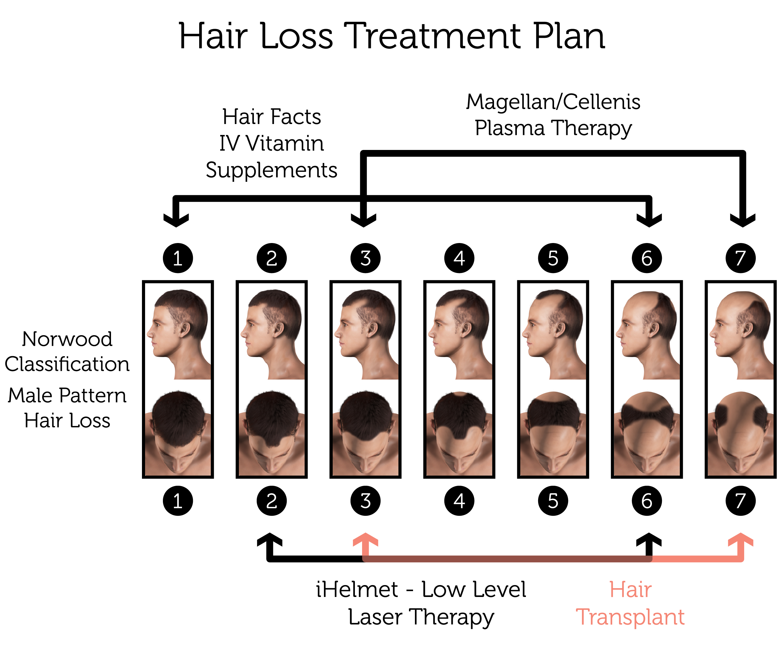 Mobile Hair Loss Treatment Plan (Male)-01