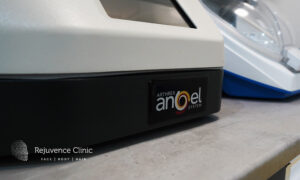 Angel PRP