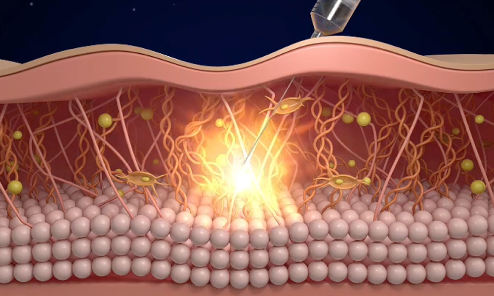 Rejuvence Clinic Blog - Insights on Anti-ageing Treatment in London 2