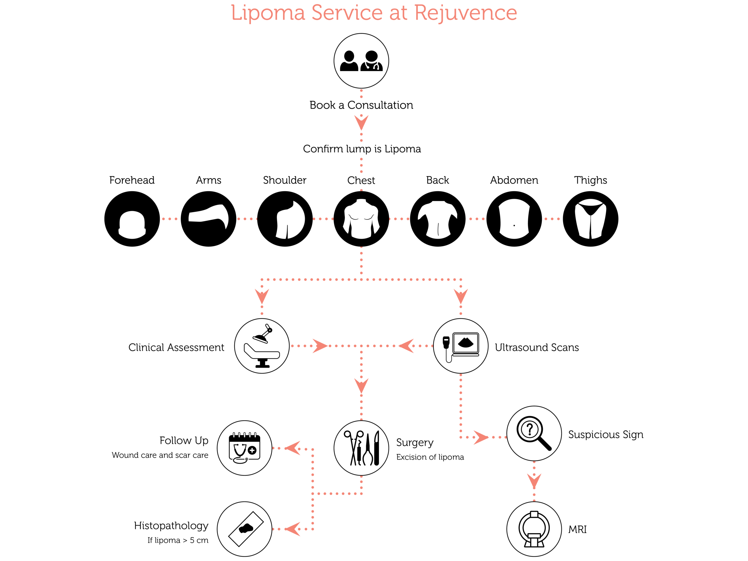 Lipoma Service scaled