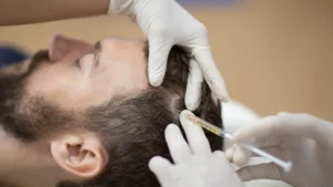Europe's Leading Skin & Hair Clinic | Keloid Specialist | Rejuvence Clinic 14 Does PRP Help With Hair Quality and Texture