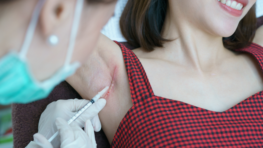 Can the NHS Treat Keloids? What UK Patients Should Know 2 Can the NHS Treat Keloids What UK Patients Should Know