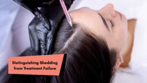 Why Am I Losing More Hair After PRP? 3 Distinguishing Shedding from Treatment Failure