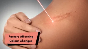 Do Keloids Change Colour Over Time? 3 Factors Affecting Colour Changes