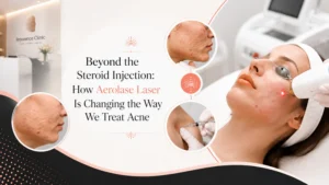 Europe's Leading Skin & Hair Clinic | Keloid Specialist | Rejuvence Clinic 11 Beyond the Steroid Injection