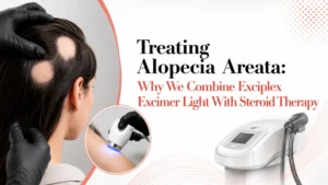 Europe's Leading Skin & Hair Clinic | Keloid Specialist | Rejuvence Clinic 12 Treating Alopecia Areata
